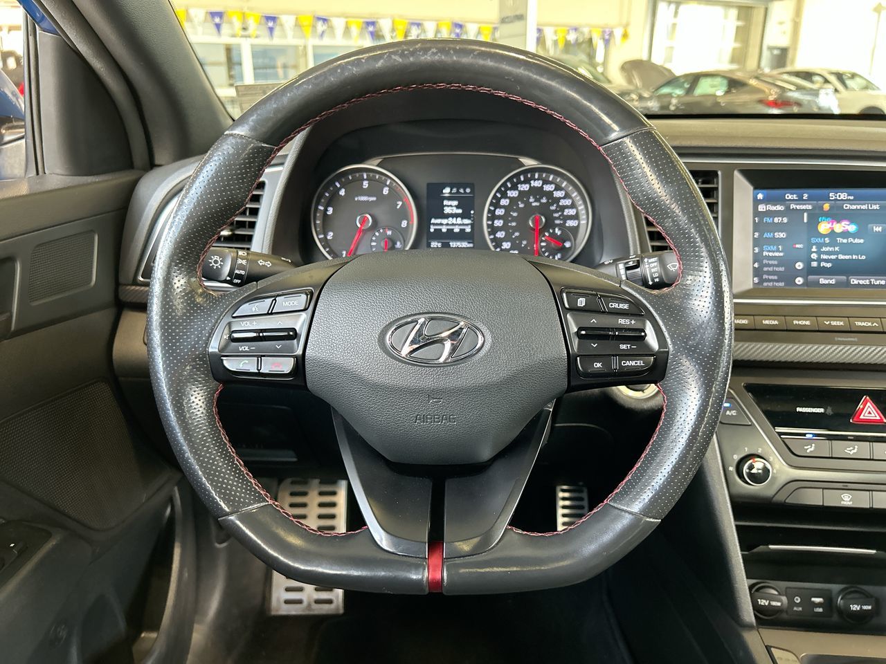 2018 Hyundai Elantra Sedan