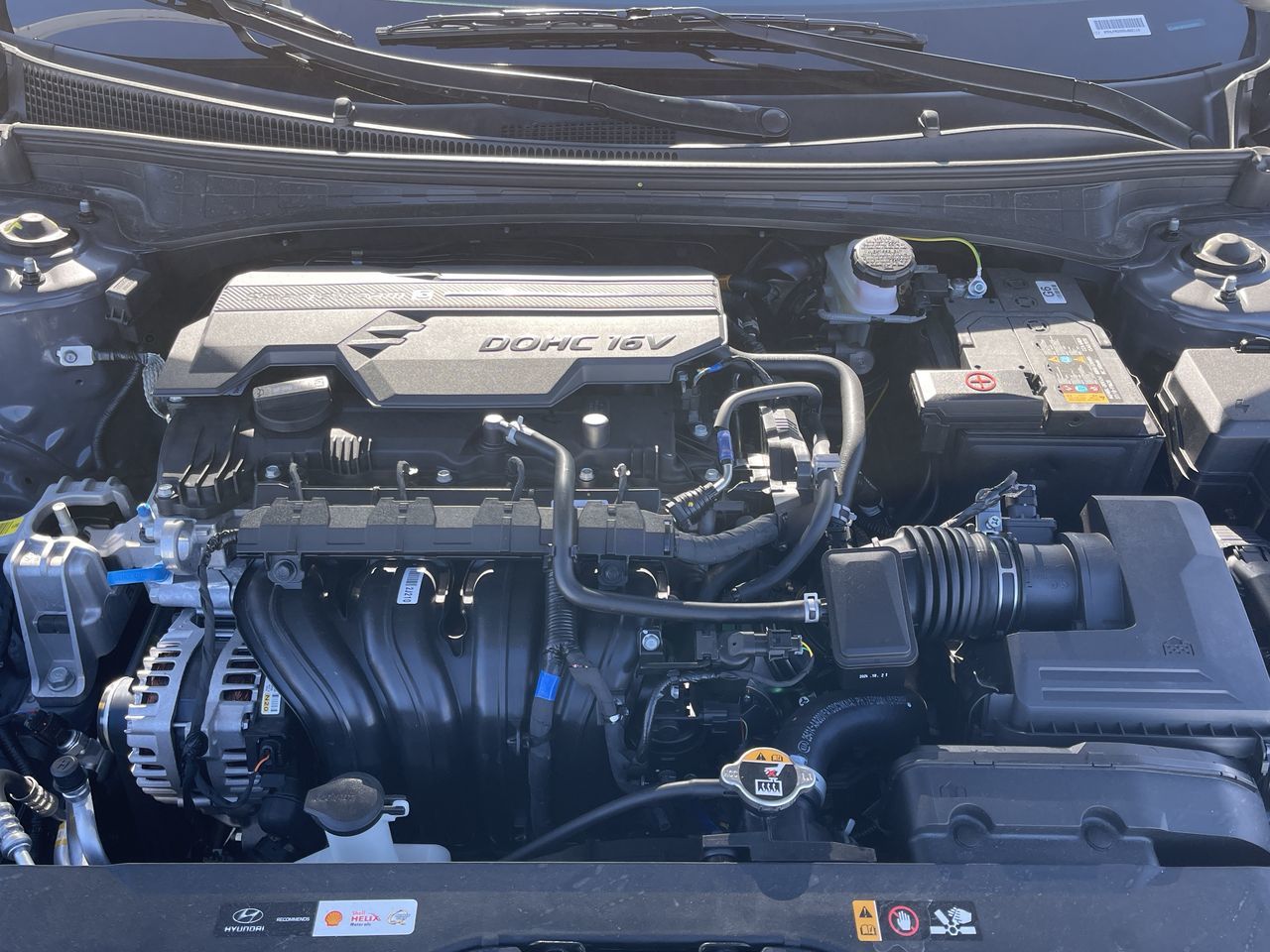 2025 Hyundai Elantra in Calgary, Alberta