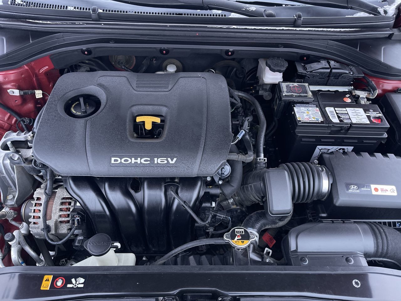 2017 Hyundai ELANTRA