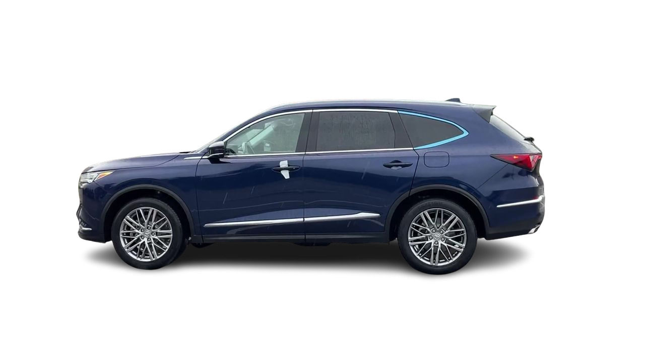 2022 Acura MDX in Markham, Ontario