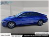 2024 Hyundai Elantra Preferred-4