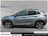 2018 Hyundai Kona 1.6T Ultimate-4