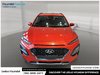 2020 Hyundai Kona 1.6T Ultimate-1