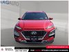 2021 Hyundai Kona 1.6T Ultimate-1