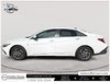 2025 Hyundai Elantra Preferred-4