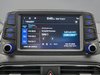 Hyundai Kona ULTIMATE AWD 2019-19