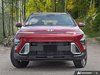 2026 Hyundai Kona Preferred-1