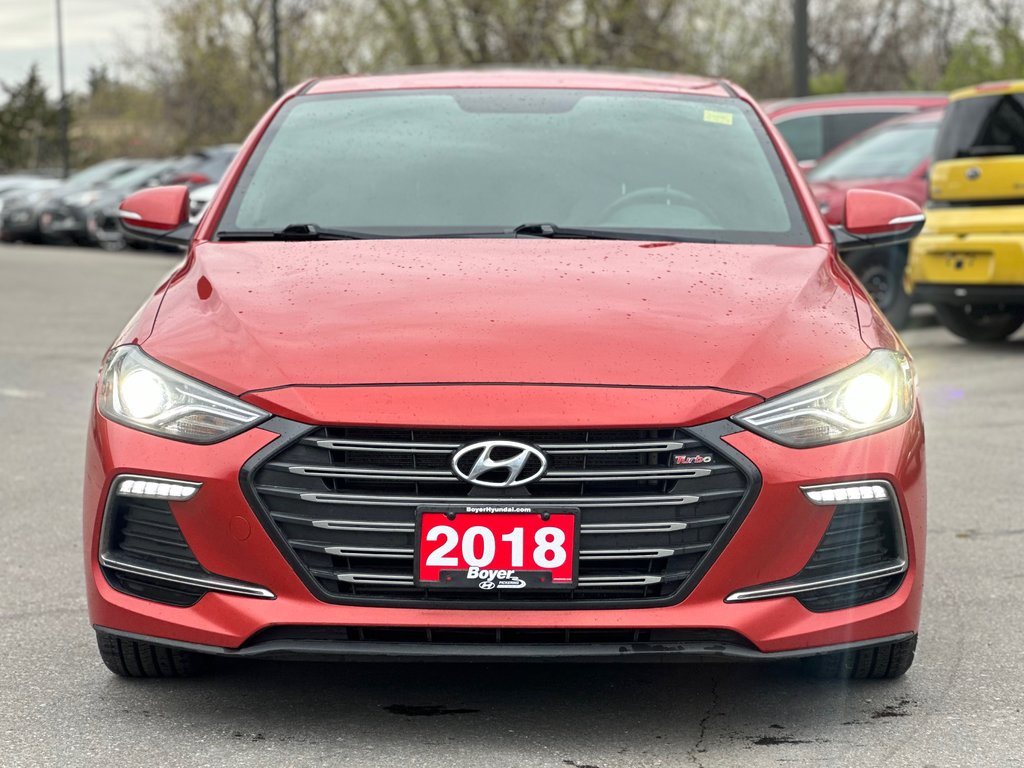 2018 Hyundai Elantra in Pickering, Ontario - 5 - w1024h768px