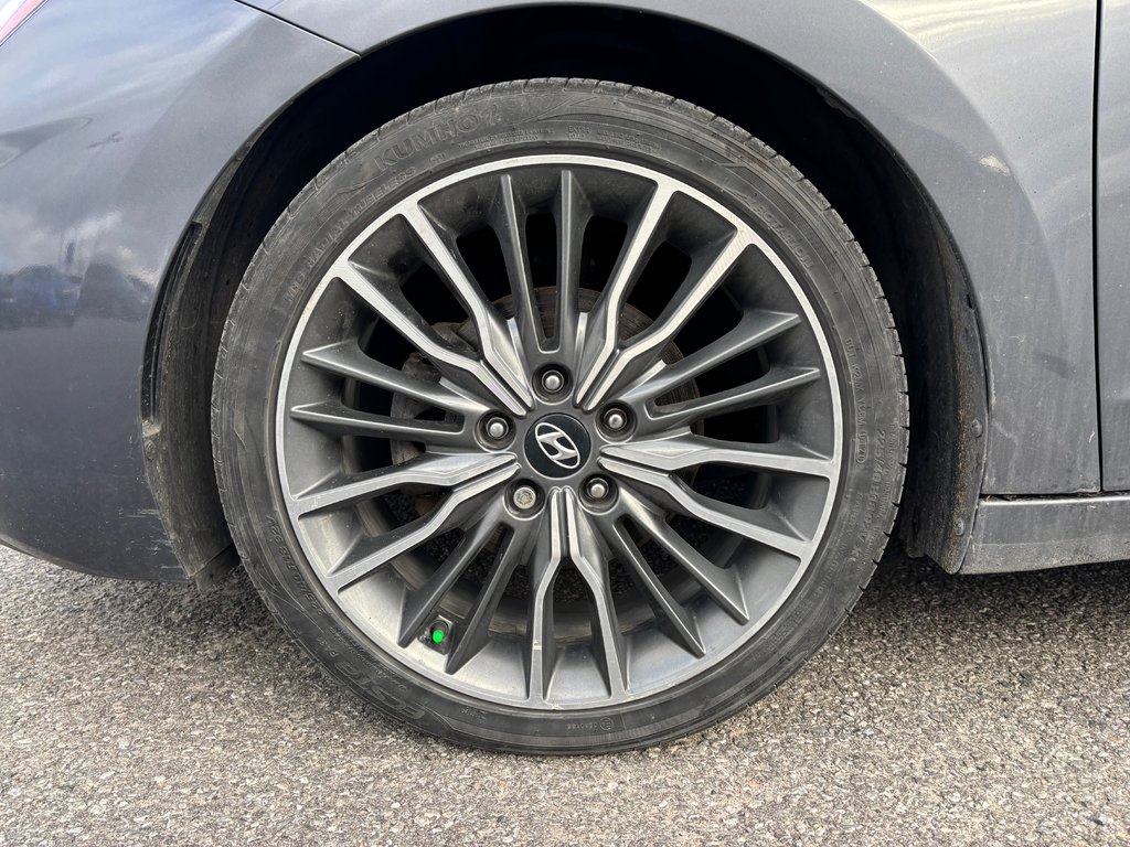 2019 Hyundai Elantra in Lindsay, Ontario - 4 - w1024h768px