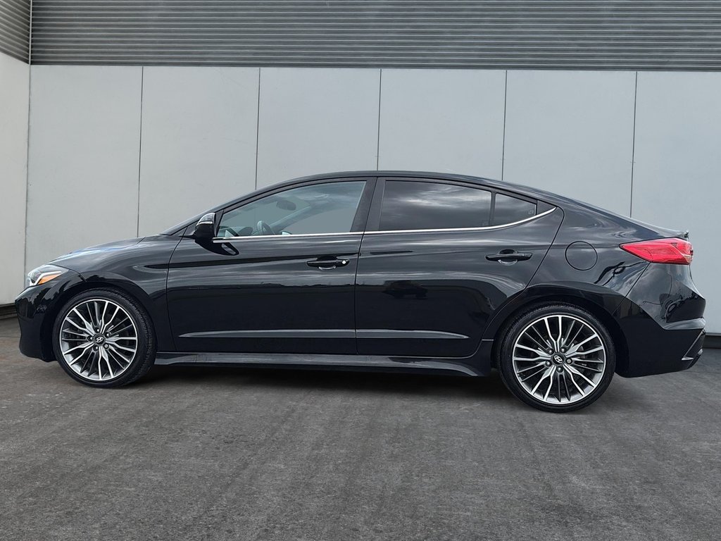 Hyundai Elantra Sport 2018 à St-Jean-Sur-Richelieu, Québec - 5 - w1024h768px