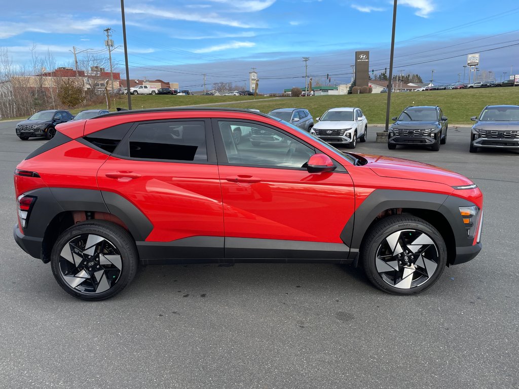 2025  Kona 1.6T Preferred Sport AWD in Bathurst, New Brunswick - 4 - w1024h768px