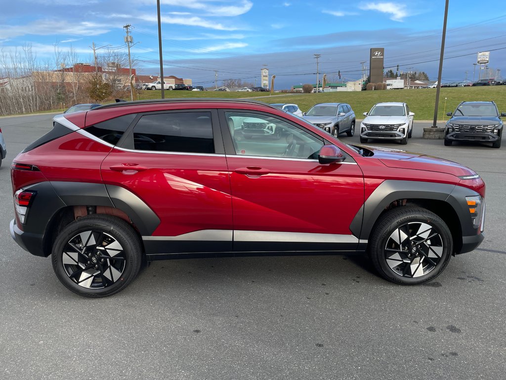 2025  Kona 2.0L Preferred AWD w/Trend Package in Bathurst, New Brunswick - 4 - w1024h768px