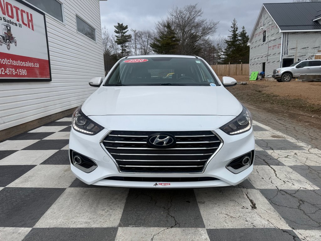 Hyundai ACCENT LIMITED Ultimate, keyless entry, backup camera, Bluetooth 2020 à COLDBROOK, Nouvelle-Écosse - 2 - w1024h768px
