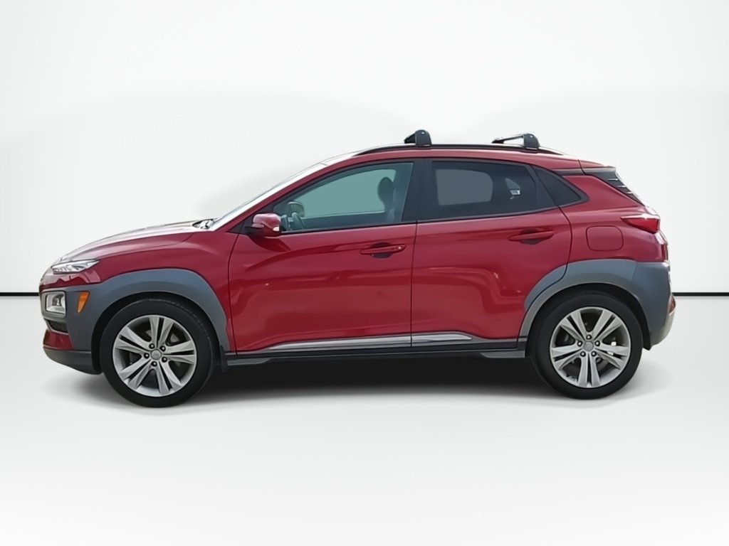 2021 Hyundai Kona Ultimate | Sunroof | Leather | Cam in Saint John, New Brunswick - 5 - w1024h768px