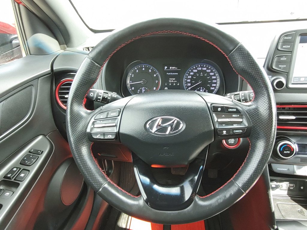 2021 Hyundai Kona Ultimate | Sunroof | Leather | Cam in Saint John, New Brunswick - 17 - w1024h768px