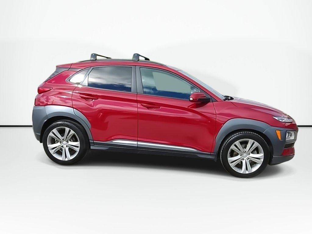 2021 Hyundai Kona Ultimate | Sunroof | Leather | Cam in Saint John, New Brunswick - 9 - w1024h768px