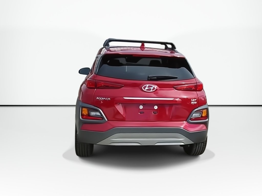 2021 Hyundai Kona Ultimate | Sunroof | Leather | Cam in Saint John, New Brunswick - 7 - w1024h768px