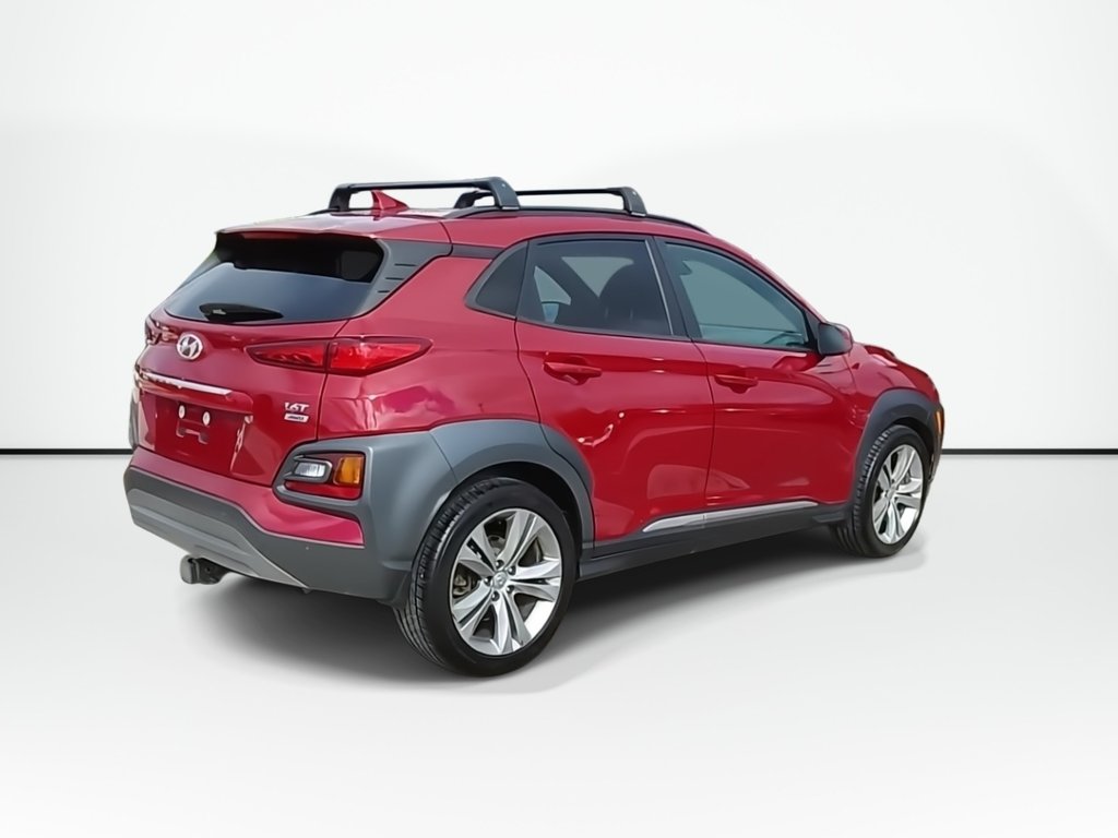 2021 Hyundai Kona Ultimate | Sunroof | Leather | Cam in Saint John, New Brunswick - 8 - w1024h768px