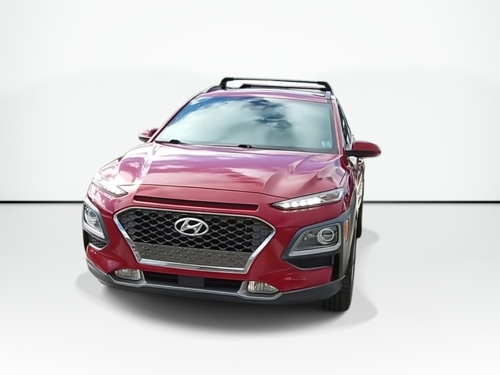 2021 Hyundai Kona Ultimate | Sunroof | Leather | Cam in Saint John, New Brunswick - 3 - w1024h768px