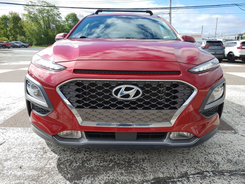 2021 Hyundai Kona Ultimate | Sunroof | Leather | Cam in Saint John, New Brunswick - 46 - w1024h768px