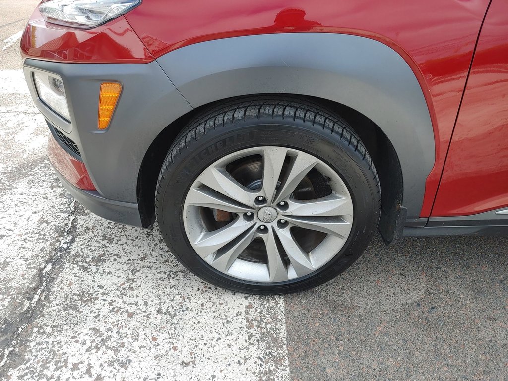 2021 Hyundai Kona Ultimate | Sunroof | Leather | Cam in Saint John, New Brunswick - 10 - w1024h768px