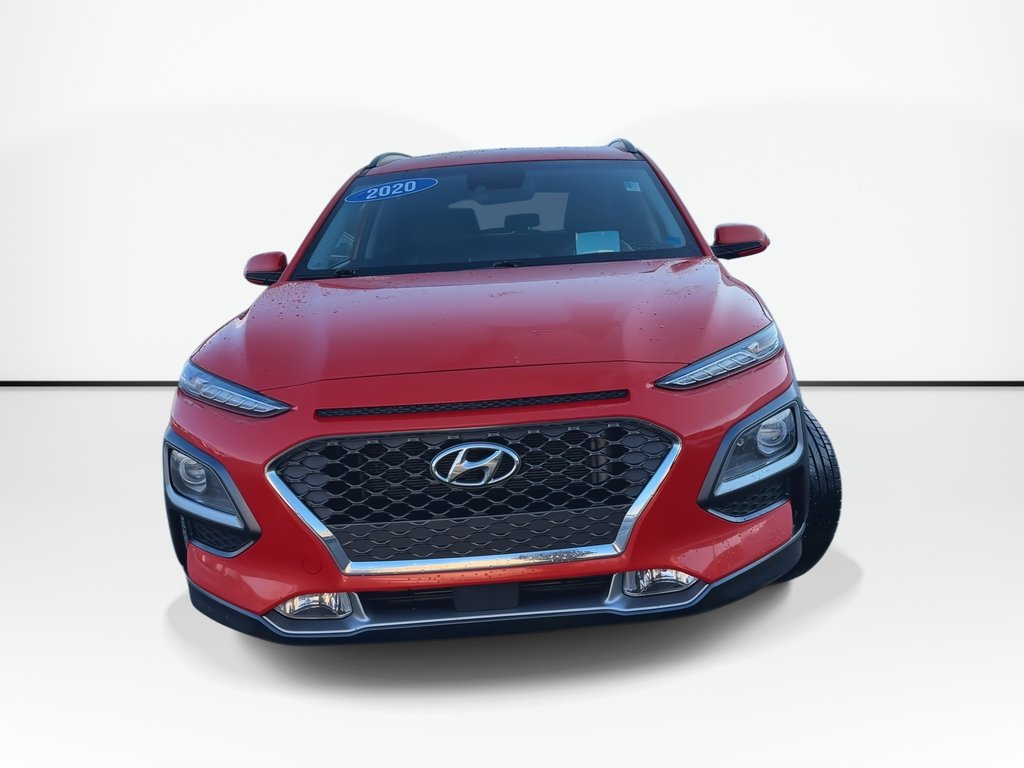 2020 Hyundai Kona Ultimate | Cam | Lthr | HtdSeats | Bluetooth | USB in Saint John, New Brunswick - 3 - w1024h768px