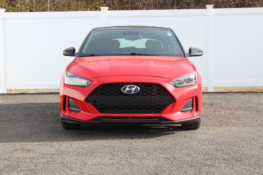 2020 Hyundai Veloster in Antigonish, Nova Scotia - 2 - w1024h768px