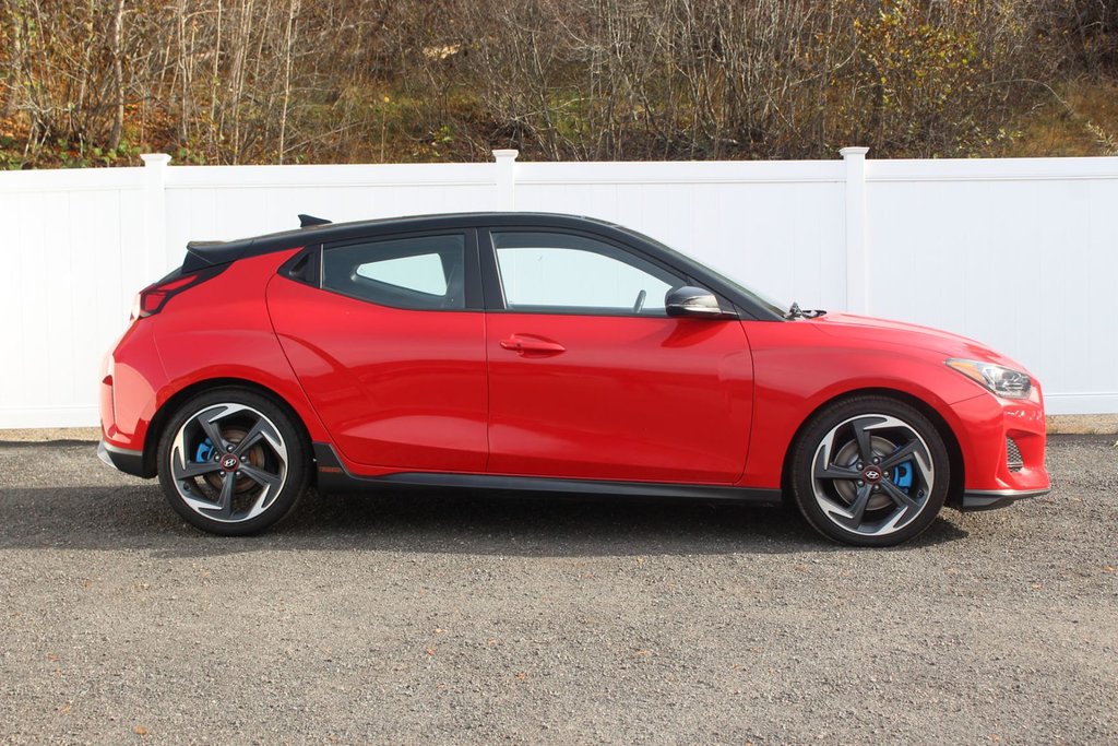 2020 Hyundai Veloster in Antigonish, Nova Scotia - 8 - w1024h768px