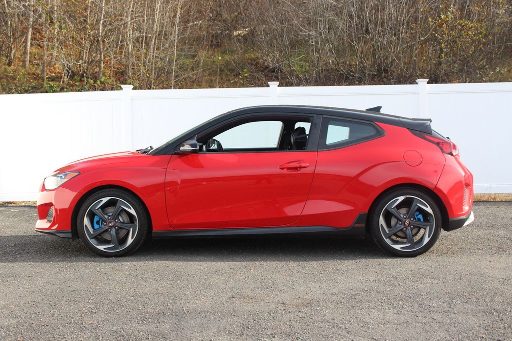 2020 Hyundai Veloster in Antigonish, Nova Scotia - 4 - w1024h768px