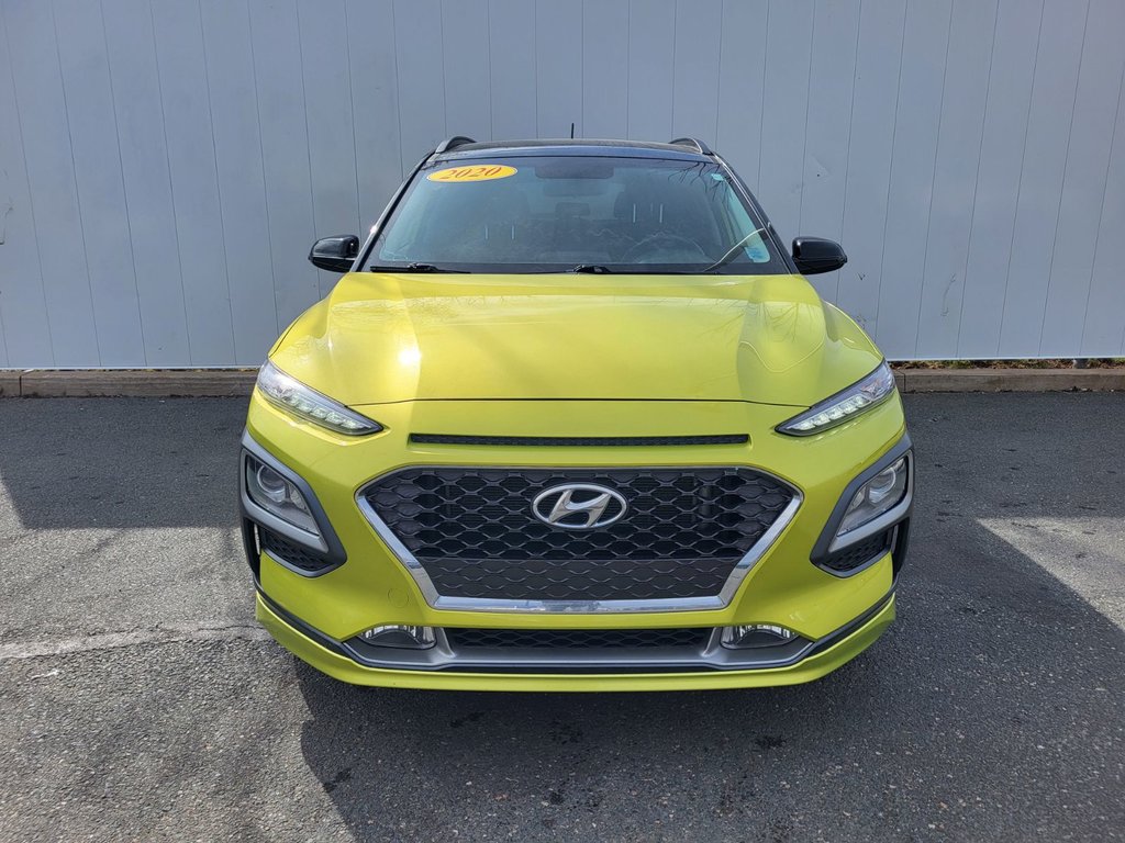 2020 Hyundai Kona in Antigonish, Nova Scotia - 6 - w1024h768px