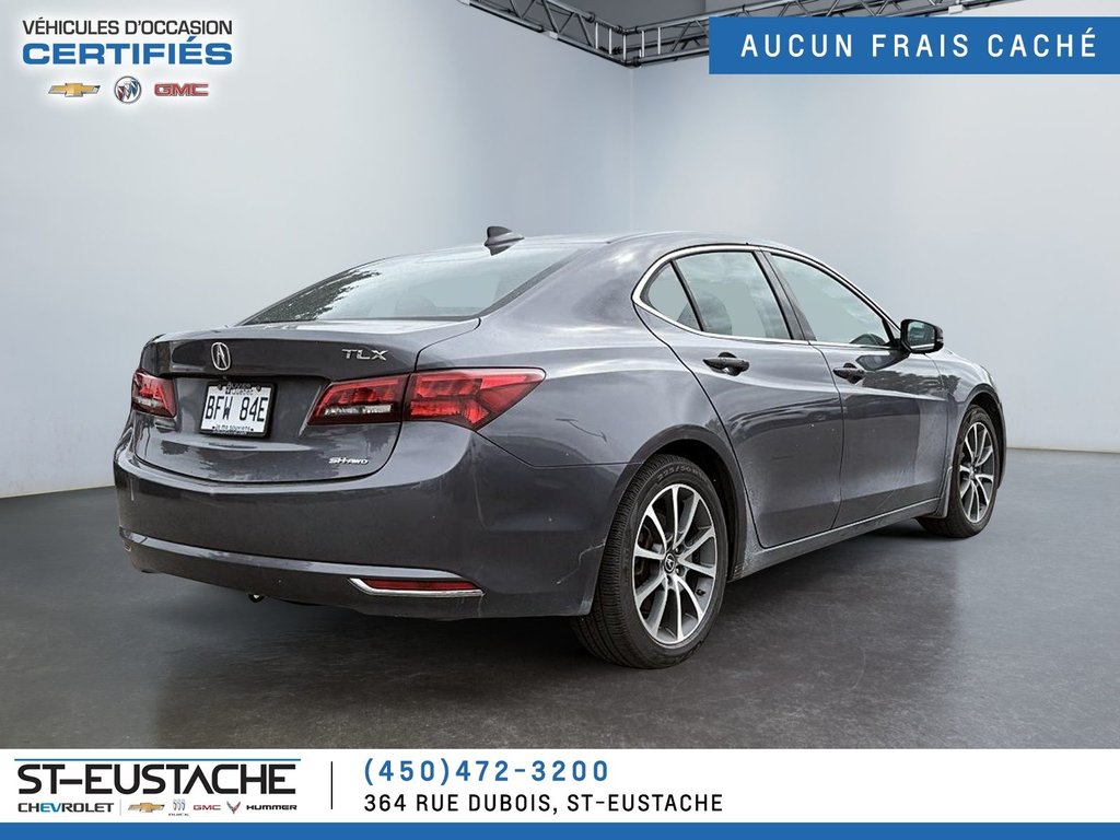 Acura TLX  2017 à Saint-Eustache, Québec - 5 - w1024h768px
