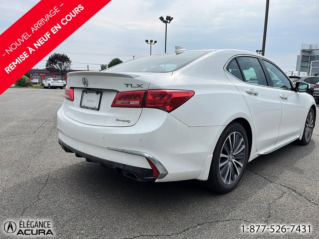 Acura TLX Elite 2018 à Granby, Québec - 4 - w1024h768px
