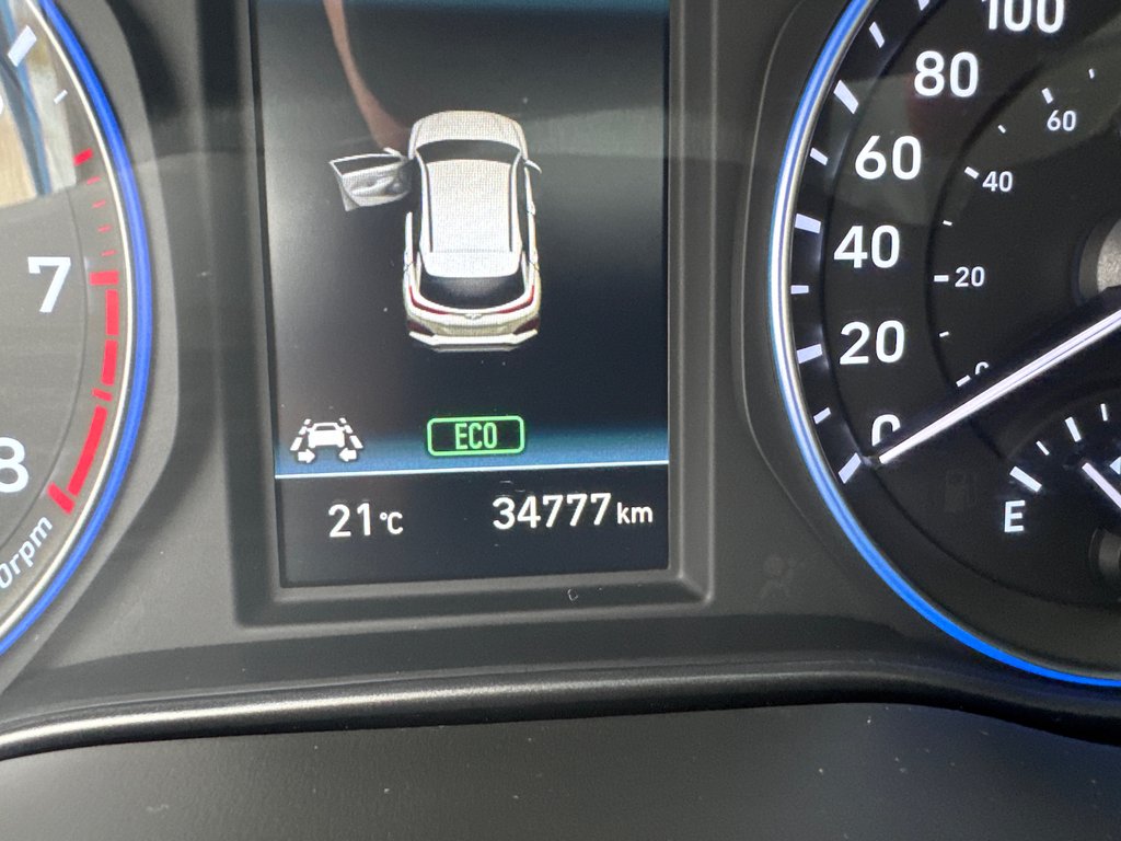 2021 Hyundai Kona Ultimate in Miramichi, New Brunswick - 3 - w1024h768px