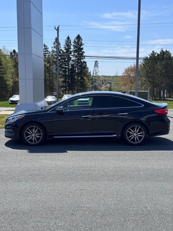2017 Hyundai Sonata 2.0T Sport Ultimate in Miramichi, New Brunswick - 4 - w1024h768px