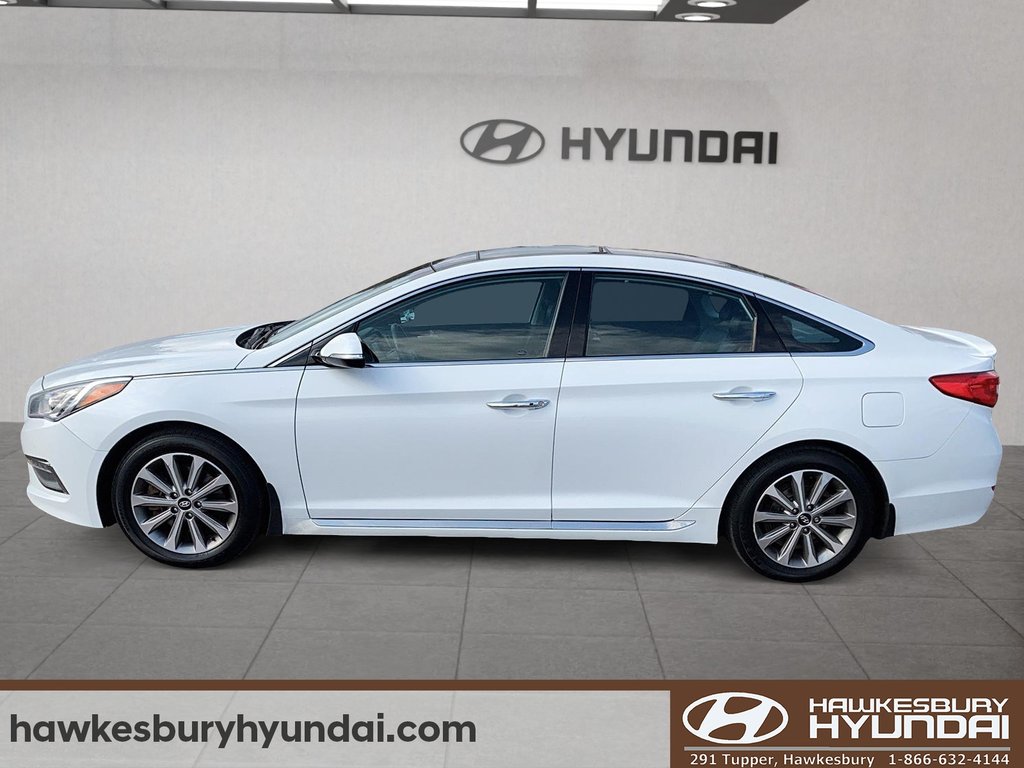 2017 Hyundai Sonata 2.4L Limited in Hawkesbury, Ontario - 5 - w1024h768px