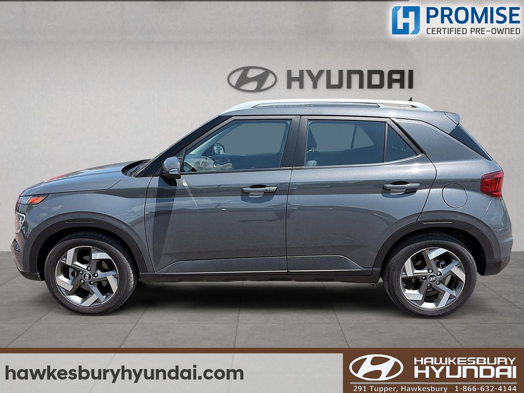 2024 Hyundai Venue ULTIMATE TOIT OUVRANT in Hawkesbury, Ontario - 5 - w1024h768px