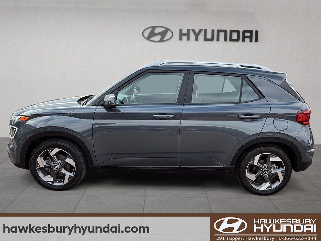 2025 Hyundai Venue Ultimate in Hawkesbury, Ontario - 5 - w1024h768px
