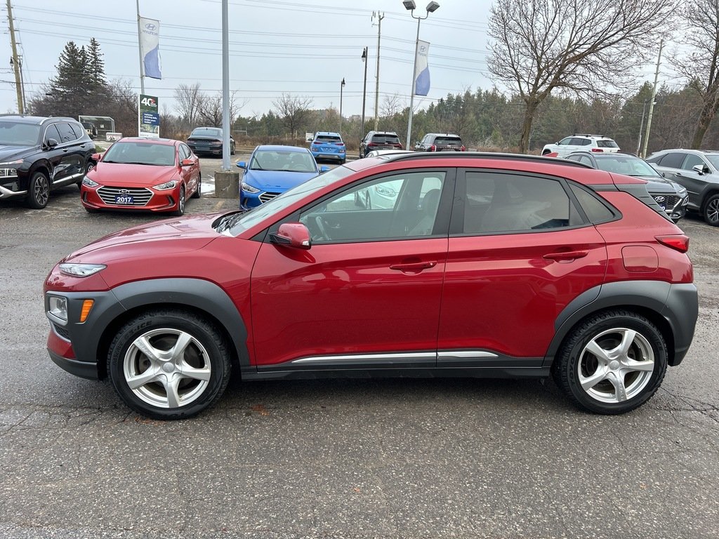 2020  Kona 1.6T AWD Ultimate in Aurora, Ontario - 6 - w1024h768px