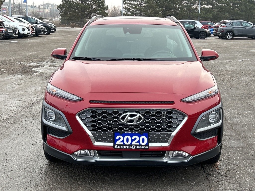 2020  Kona 1.6T AWD Ultimate in Aurora, Ontario - 8 - w1024h768px