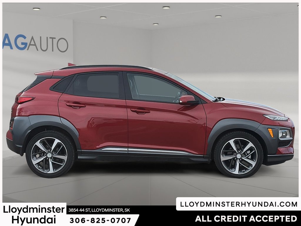 2019 Hyundai Kona 1.6T Ultimate in Lloydminster, Saskatchewan - 4 - w1024h768px