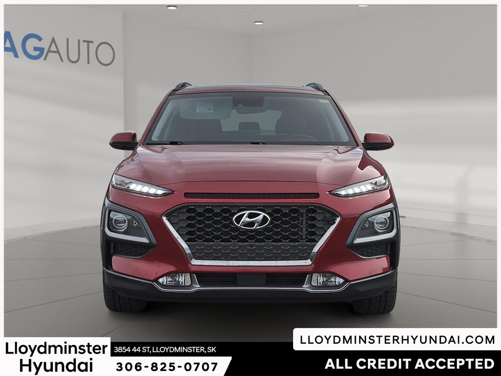 2019 Hyundai Kona 1.6T Ultimate in Lloydminster, Saskatchewan - 2 - w1024h768px