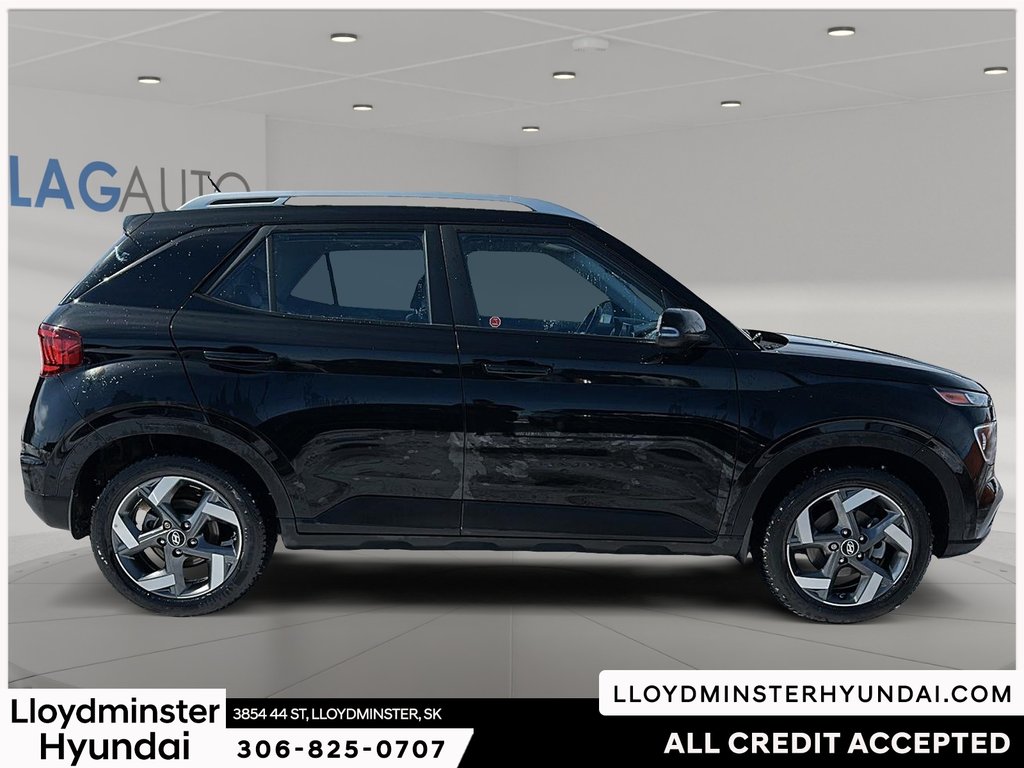 2025 Hyundai Venue Ultimate in Lloydminster, Saskatchewan - 4 - w1024h768px