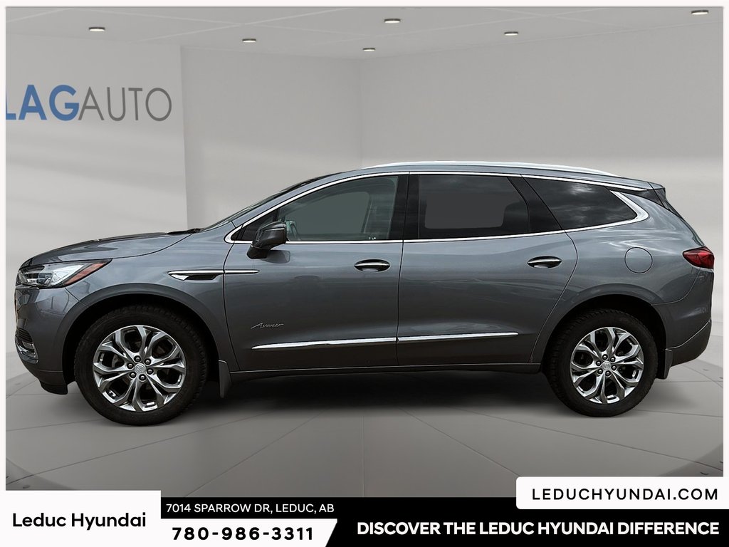 2020 Buick Enclave Avenir in Leduc, Alberta - 5 - w1024h768px