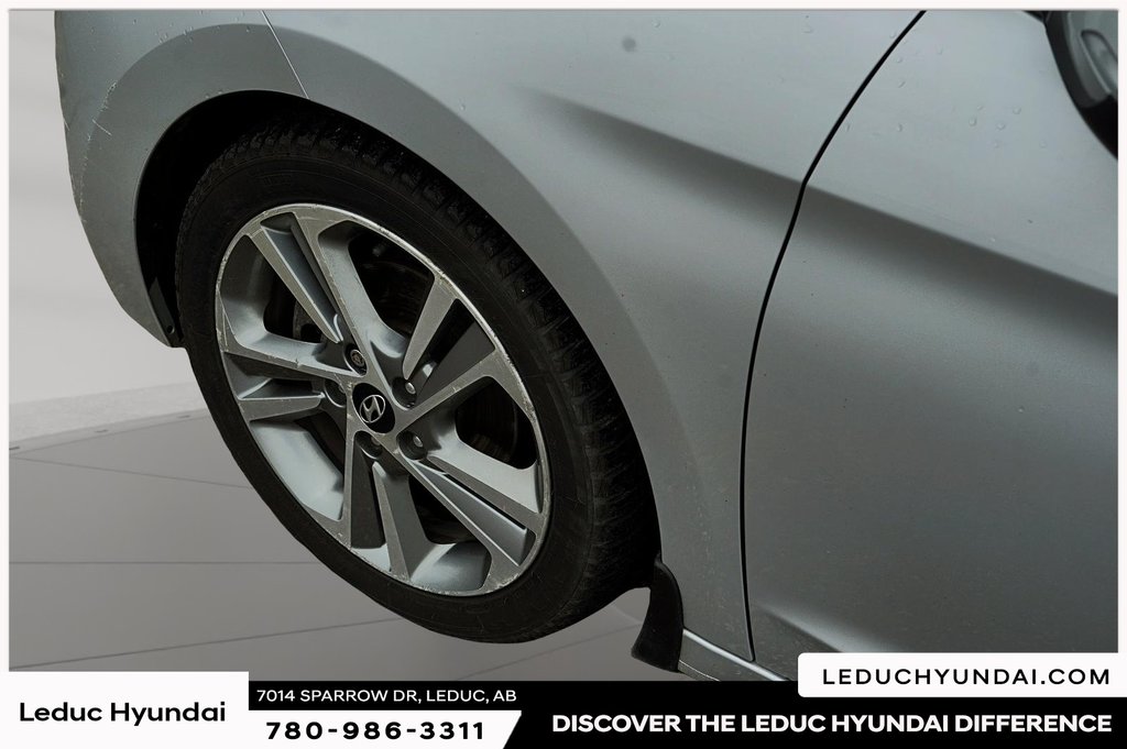 2017 Hyundai Elantra Limited Ultimate in Leduc, Alberta - 6 - w1024h768px