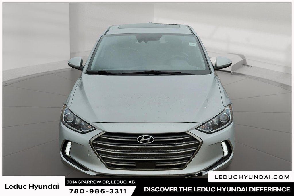 2017 Hyundai Elantra Limited Ultimate in Leduc, Alberta - 2 - w1024h768px
