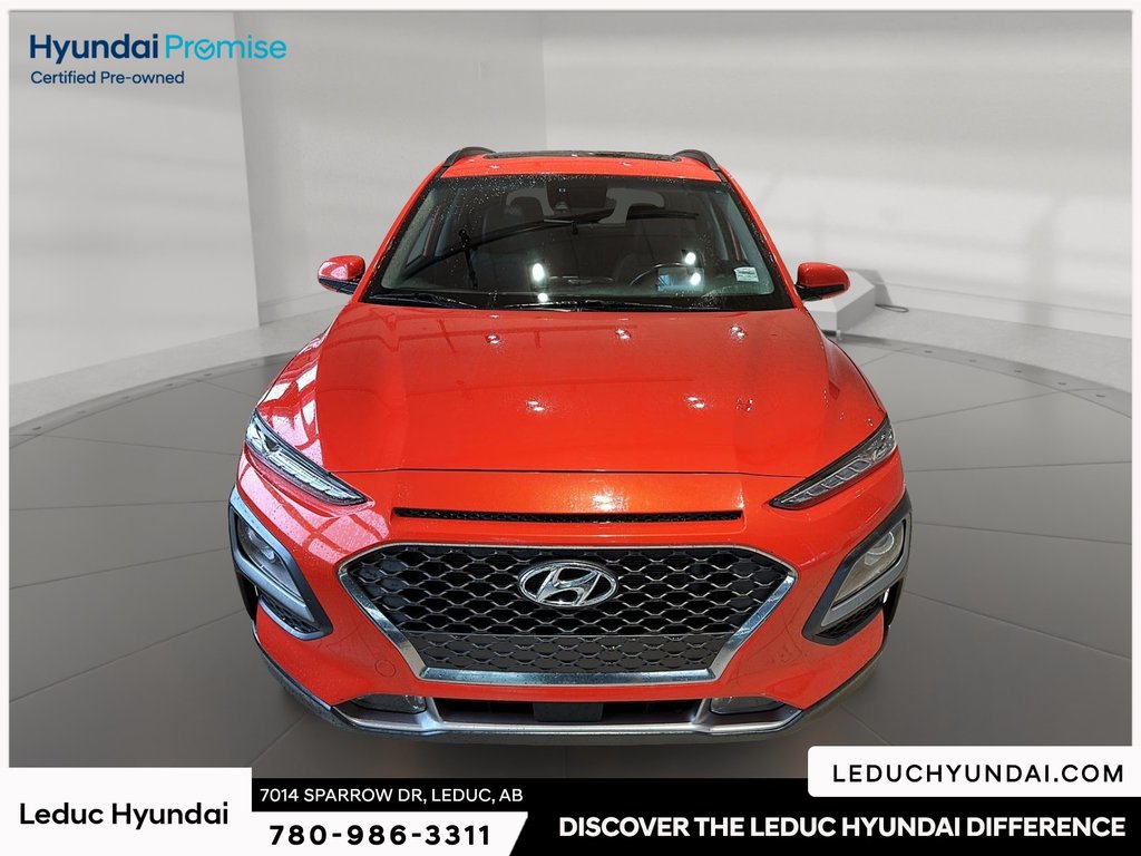 2020 Hyundai Kona 1.6T Ultimate in Leduc, Alberta - 2 - w1024h768px