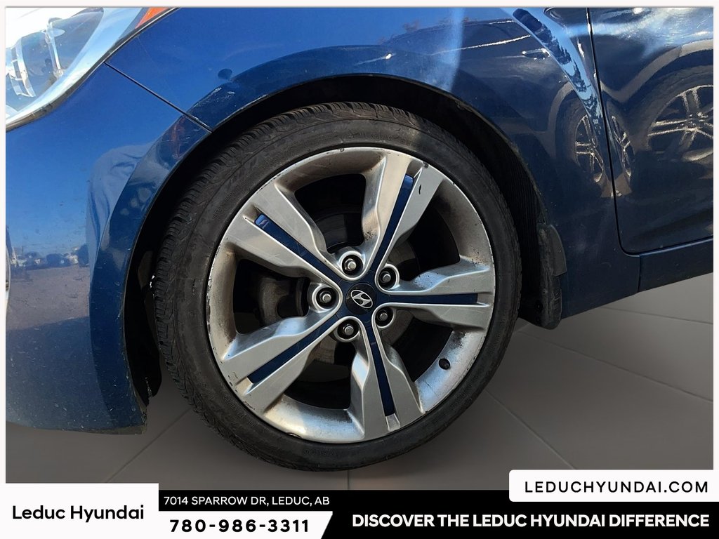 2016 Hyundai Veloster Tech in Leduc, Alberta - 4 - w1024h768px