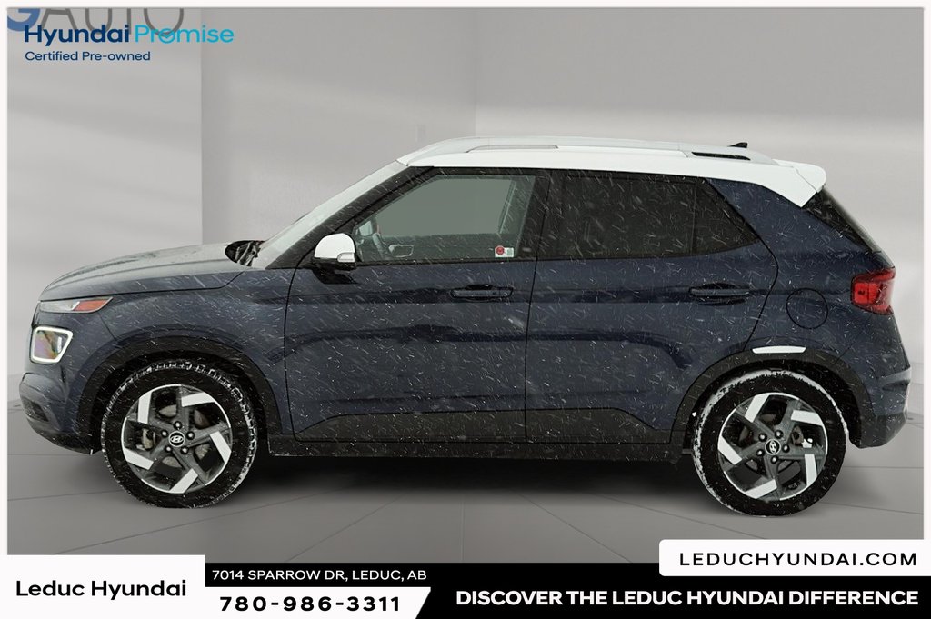 2020 Hyundai Venue Ultimate in Leduc, Alberta - 5 - w1024h768px