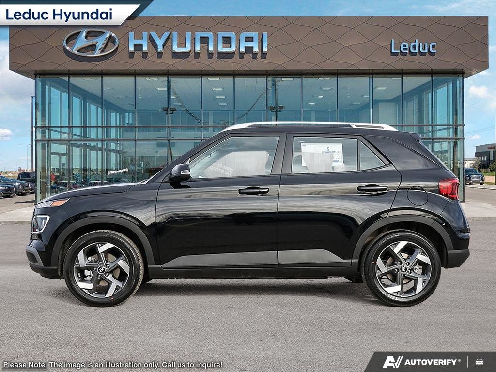 2025 Hyundai Venue Ultimate - Black interior in Leduc, Alberta - 3 - w1024h768px