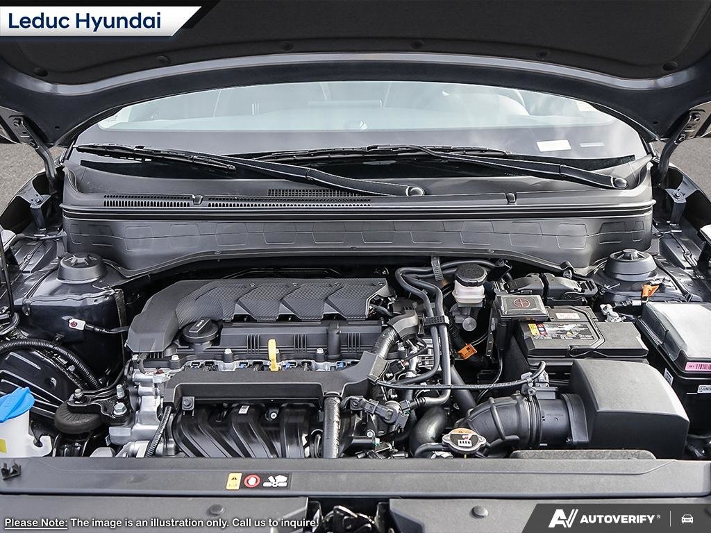 2025 Hyundai Venue Ultimate - Black interior in Leduc, Alberta - 6 - w1024h768px